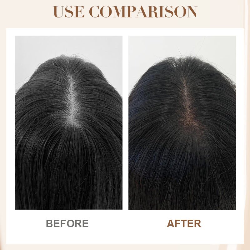 Anti - Hair Loss Strengthening Shampoo - GoMart!