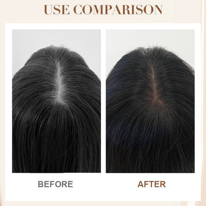 Anti - Hair Loss Strengthening Shampoo - GoMart!